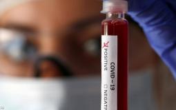 الأبحاث تكشف فصيلة الدم الأكثر عرضة لخطر كورونا.JPG
