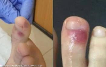 اعراض جديدة.JPG