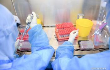 لقاح صيني.jpg