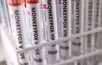 جدري القرود.jpg