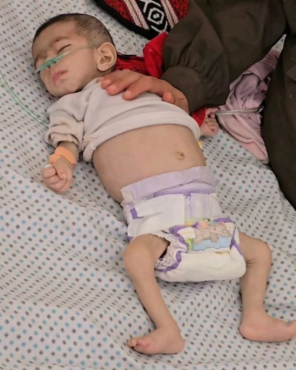 غزة مجاعة (3).jpg
